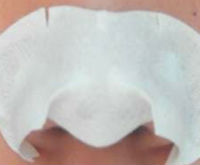 nose-pack_w200.jpg